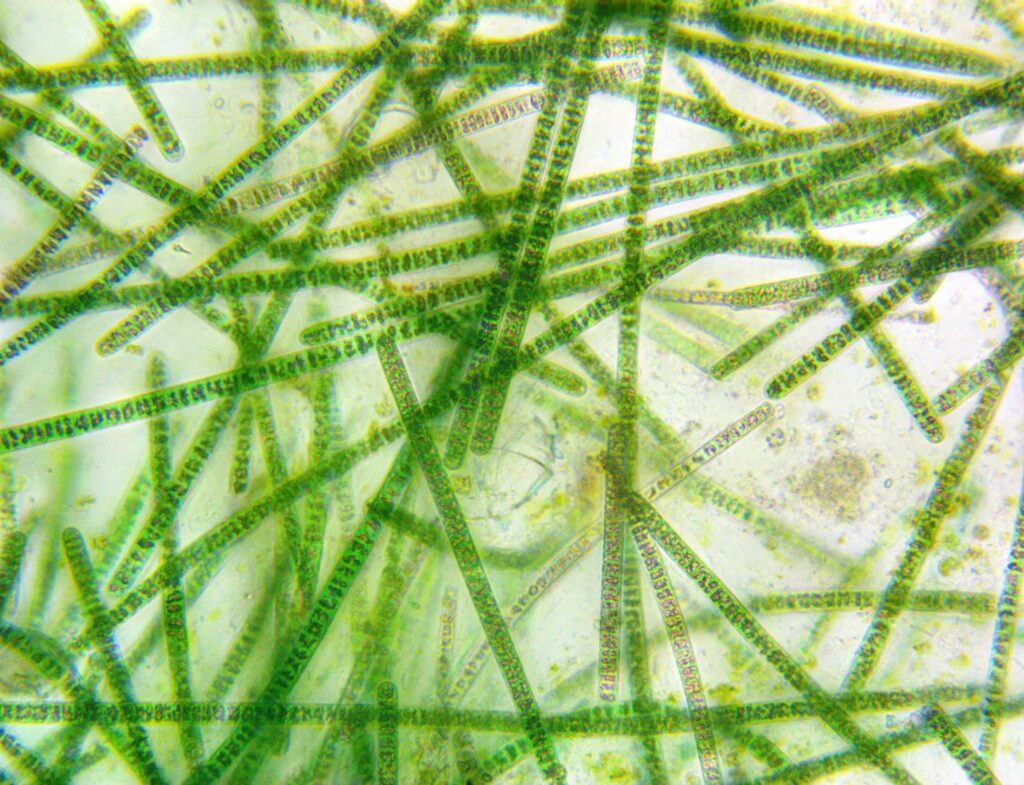 An image of algae under a microscope